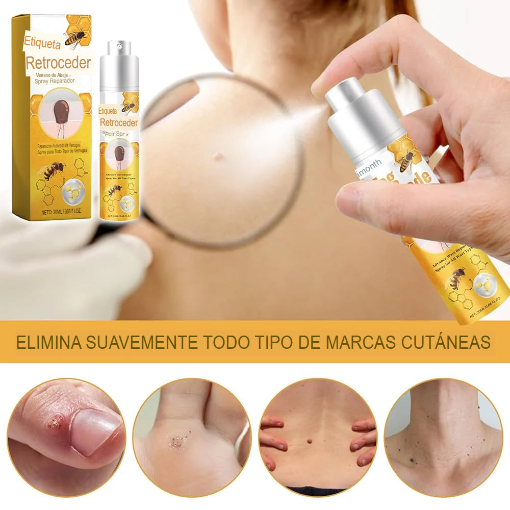 Tag Recede™ – Elimina verrugas y marcas sin dolor