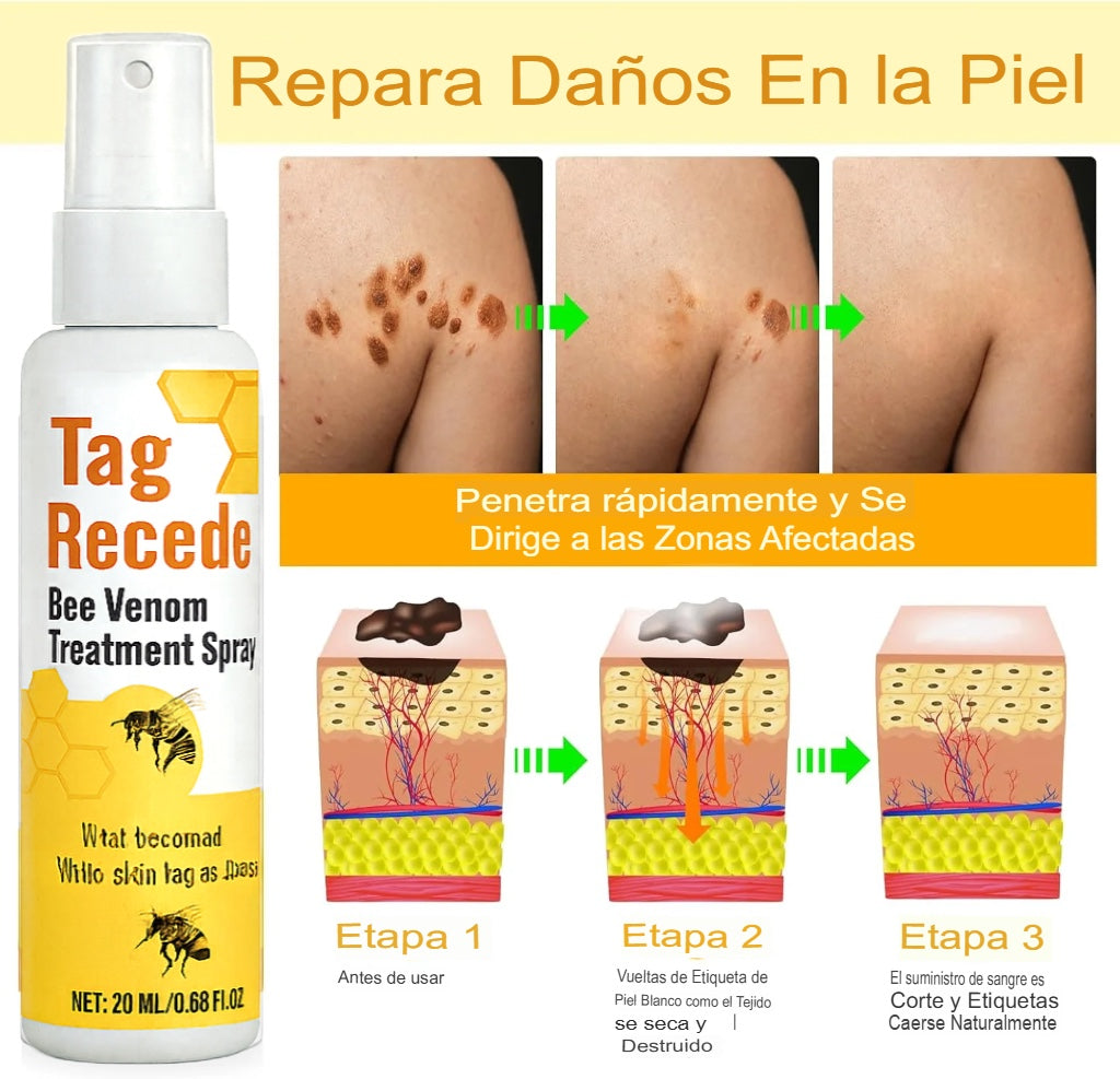 Tag Recede™ – Elimina verrugas y marcas sin dolor